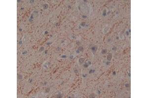 Used in DAB staining on fromalin fixed paraffin- embedded brain tissue