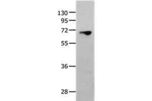 Western Blot analysis of 823 cell using MMP25 Polyclonal Antibody at dilution of 1:1300 (MMP25 anticorps)