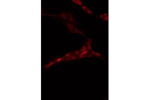 ABIN6274480 staining 293 by IF/ICC. (LMTK3 anticorps)