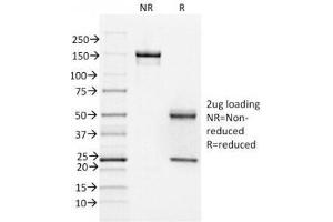 SDS-PAGE Analysis of Purified, BSA-Free FOXA1 Antibody (clone FOXA1/1518). (FOXA1 anticorps  (AA 372-472))