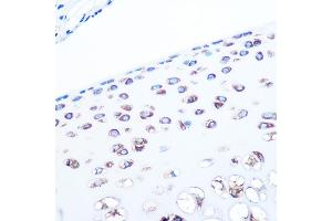 Immunohistochemistry of paraffin-embedded rat bone marrow using ALDOA Rabbit mAb (ABIN7265550) at dilution of 1:100 (40x lens). (ALDOA anticorps)