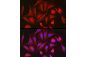 Immunofluorescence analysis of U2OS cells using PGD Rabbit pAb (ABIN6127314, ABIN6145502, ABIN6145503 and ABIN6223639) at dilution of 1:50 (40x lens).