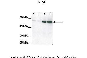 Lanes:   Lane1: 100ug untransfected RPE-1 lysate Lane2: 100ug untransfected RPE-1 lysate Lane3: 100ug STK3 induced RPE-1 lysate Lane4: 100ug STK3 induced RPE-1 lysate  Primary Antibody Dilution:   1:2000  Secondary Antibody:   Anti-rabbit HRP  Secondary Antibody Dilution:   1:5000  Gene Name:   STK3  Submitted by:   Anonymous