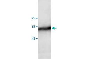 Western blot analysis of human fetal liver tissue lysate with ADAM15 polyclonal antibody  at 1:200 dilution. (ADAM15 anticorps)