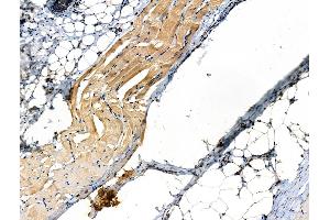 Phospho-ILK (Thr173) Antibody at 1/100 staining Rat skin tissue by IHC-P.