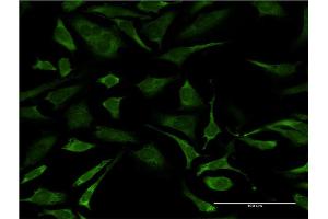 Immunofluorescence of monoclonal antibody to ERCC2 on HeLa cell.