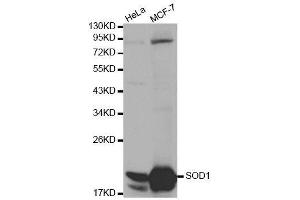 Western blot analysis of extracts of various cell lines, using SOD1 antibody. (SOD1 anticorps  (AA 1-154))