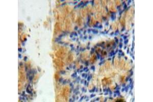 IHC-P analysis of Bowels tissue, with DAB staining. (PICK1 anticorps  (AA 24-229))