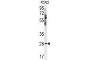 HSD11B1L Antibody Western blot analysis in K562 cell line lysates (35ug/lane). (HSD11B1L anticorps  (C-Term))