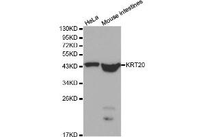 Western blot analysis of extracts of various cell lines, using KRT20 antibody.