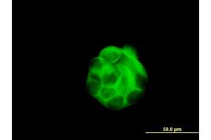 Immunofluorescence of monoclonal antibody to SGCB on MCF-7 cell.