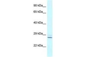 Image no. 1 for anti-Tubulin Polymerization Promoting Protein (Tppp) (N-Term) antibody (ABIN6747493) (Tppp anticorps  (N-Term))