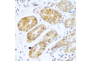 Immunohistochemistry of paraffin-embedded human stomach using NCAM1 antibody. (CD56 anticorps  (AA 759-858))