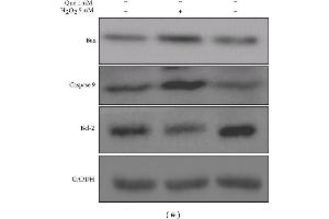 Effects of quercetin on cell apoptosis in H2O2-treated H9C2 cells. (Caspase 9 anticorps)
