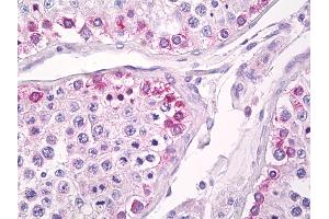 Anti-USP13 antibody IHC of human testis.