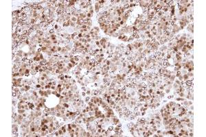 IHC-P Image Immunohistochemical analysis of paraffin-embedded N87 Xenograft , using Annexin I, antibody at 1:500 dilution.