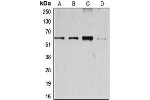 Western blot analysis of Cyclin B1 expression in Jurkat (A), K562 (B), HEK293T (C), HeLa (D) whole cell lysates. (Cyclin B1 anticorps  (Center))