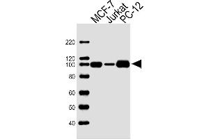 Lane 1: MCF-7 Cell lysates, Lane 2: Sample Tissue/Cell lysates, Lane 3: PC-12 Cell lysates, probed with TOP1 (1291CT875. (Topoisomerase I anticorps)