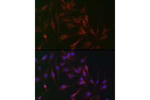Immunofluorescence analysis of C6 cells using IL6ST antibody (ABIN7268003) at dilution of 1:100.