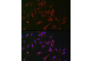 Immunofluorescence analysis of C6 cells using IL6ST antibody (ABIN7268003) at dilution of 1:100. (CD130/gp130 anticorps  (AA 678-857))