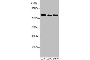 Western blot All lanes: PRPF4 antibody at 2. (PRPF4 anticorps  (AA 1-260))
