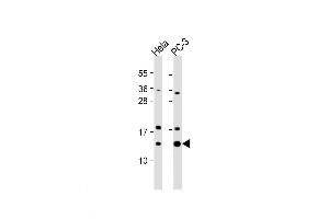 Western Blot at 1:1000 dilution Lane 1: Hela whole cell lysate Lane 2: PC-3 whole cell lysate Lysates/proteins at 20 ug per lane.