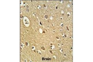 Formalin-fixed and paraffin-embedded human brain tissue reacted with OMD Antibody (C-term), which was peroxidase-conjugated to the secondary antibody, followed by DAB staining. (Osteomodulin anticorps  (C-Term))