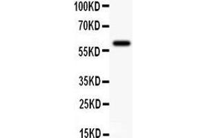 Anti-KCNN antibody,  Western blotting All lanes: Anti KCNN() at 0. (KCNN4 anticorps  (N-Term))