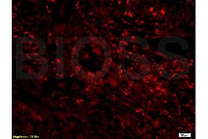 Formalin-fixed and rat colitis tissue labeled with Anti-CD68 Polyclonal Antibody, Unconjugated (ABIN671406) at 1:200 followed by conjugation to the secondary antibody, Goat Anti-Rabbit IgG, Cy5 conjugated,