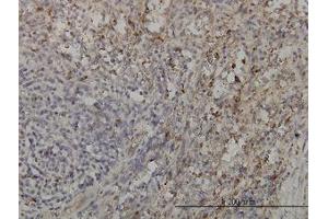 Image no. 2 for anti-GRB2-Related Adaptor Protein 2 (GRAP2) (AA 226-316) antibody (ABIN599077) (GRAP2 anticorps  (AA 226-316))