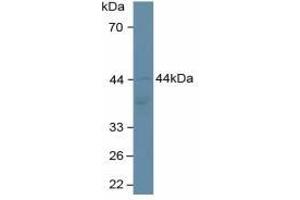 Adiponectin Receptor 2 (ADIPOR2) ELISA Kit