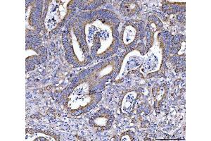 IHC analysis of EIF3A using anti-EIF3A antibody (ABIN7599942).