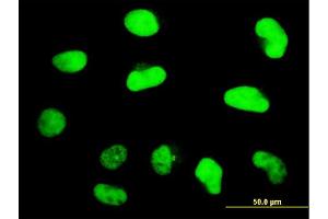 Immunofluorescence of monoclonal antibody to ZNF207 on HeLa cell. (ZNF207 anticorps  (AA 1-110))