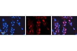 PAPSS2 antibody - C-terminal region          Formalin Fixed Paraffin Embedded Tissue:  Human Lung Tissue    Observed Staining:  Cytoplasm of pneumocytes   Primary Antibody Concentration:  1:100    Secondary Antibody:  Donkey anti-Rabbit-Cy3    Secondary Antibody Concentration:  1:200    Magnification:  20X    Exposure Time:  0.