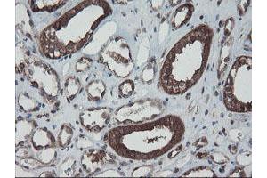 Image no. 12 for anti-SKI-Like Oncogene (SKIL) (AA 307-684) antibody (ABIN1491380) (SKIL anticorps  (AA 307-684))