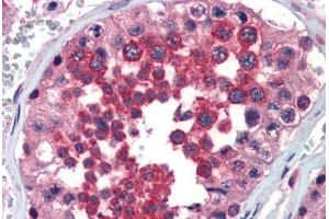 Human Testis (formalin-fixed, paraffin-embedded) stained with FHL1 antibody ABIN462171 followed by biotinylated goat anti-rabbit IgG secondary antibody ABIN481713, alkaline phosphatase-streptavidin and chromogen.