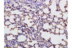 Formalin-fixed and paraffin embedded rat lung tissue labeled with Anti-FBP1 Polyclonal Antibody, unconjugated (ABIN752053) at 1:200 followed by incubation with conjugated secondary antibody (FBP1 anticorps  (AA 31-130))