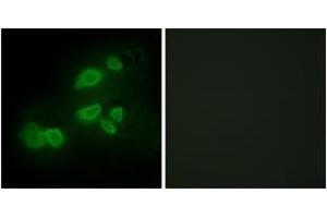 Immunofluorescence analysis of HepG2 cells, using CDCP1 Antibody. (CDCP1 anticorps  (AA 691-740))