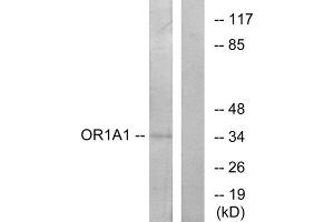 Western blot analysis of extracts from COLO cells, using OR1A1 antibody. (OR1A1 anticorps  (C-Term))
