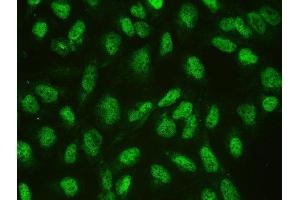 IF analysis of CTBP1 using anti-CTBP1 antibody (ABIN3043816). (CTBP1 anticorps  (C-Term))