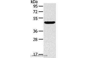 Western blot analysis of Mouse liver tissue, using TM7SF2 Polyclonal Antibody at dilution of 1:400 (TM7SF2 anticorps)