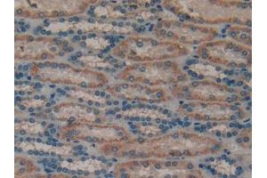 IHC-P analysis of Human Kidney Tissue, with DAB staining. (MUC1 anticorps  (AA 1098-1255))