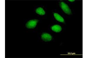 Immunofluorescence of purified MaxPab antibody to SUHW1 on HeLa cell. (ZNF280A anticorps  (AA 1-542))
