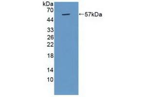 Detection of Recombinant CTSG, Human using Polyclonal Antibody to Cathepsin G (CTSG)
