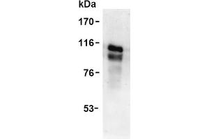 Western Blotting (WB) image for anti-Tumor Necrosis Factor Receptor Superfamily, Member 8 (TNFRSF8) antibody (ABIN492585)
