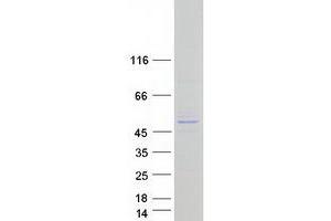 Validation with Western Blot (SLX4IP Protein (Myc-DYKDDDDK Tag))