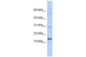 FAM14A antibody used at 1 ug/ml to detect target protein. (IFI27L2 anticorps  (Middle Region))