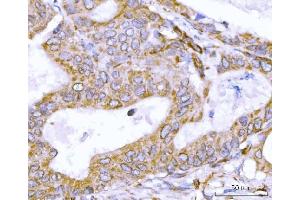 IHC analysis of Nesprin 2/SYNE2 using anti-Nesprin 2/SYNE2 antibody (ABIN7601532).