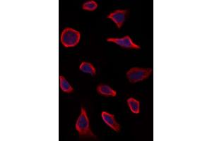 ABIN6263303 and ABIN6273267 staining Hela by IF/ICC. (MMP28 anticorps  (Internal Region))
