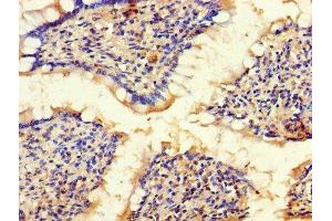 Immunohistochemistry of paraffin-embedded human small intestine tissue using ABIN7145600 at dilution of 1:100 (BLOC1S1 anticorps  (AA 1-153))